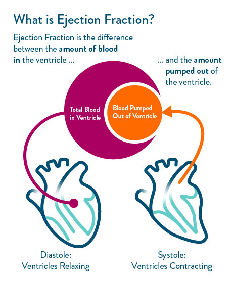 What is Ejection Fraction